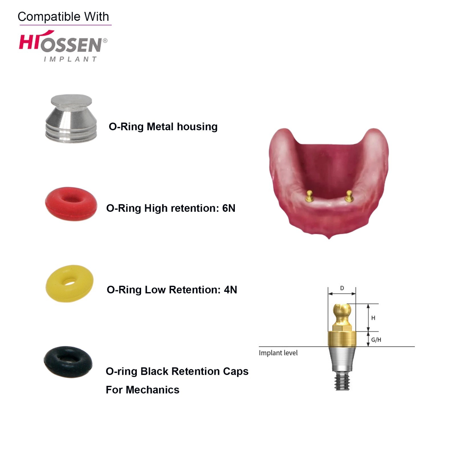 US Dental O-ring 4Pcs/Set for Ball Attachment Abutment Compatible Hiossen Osstem