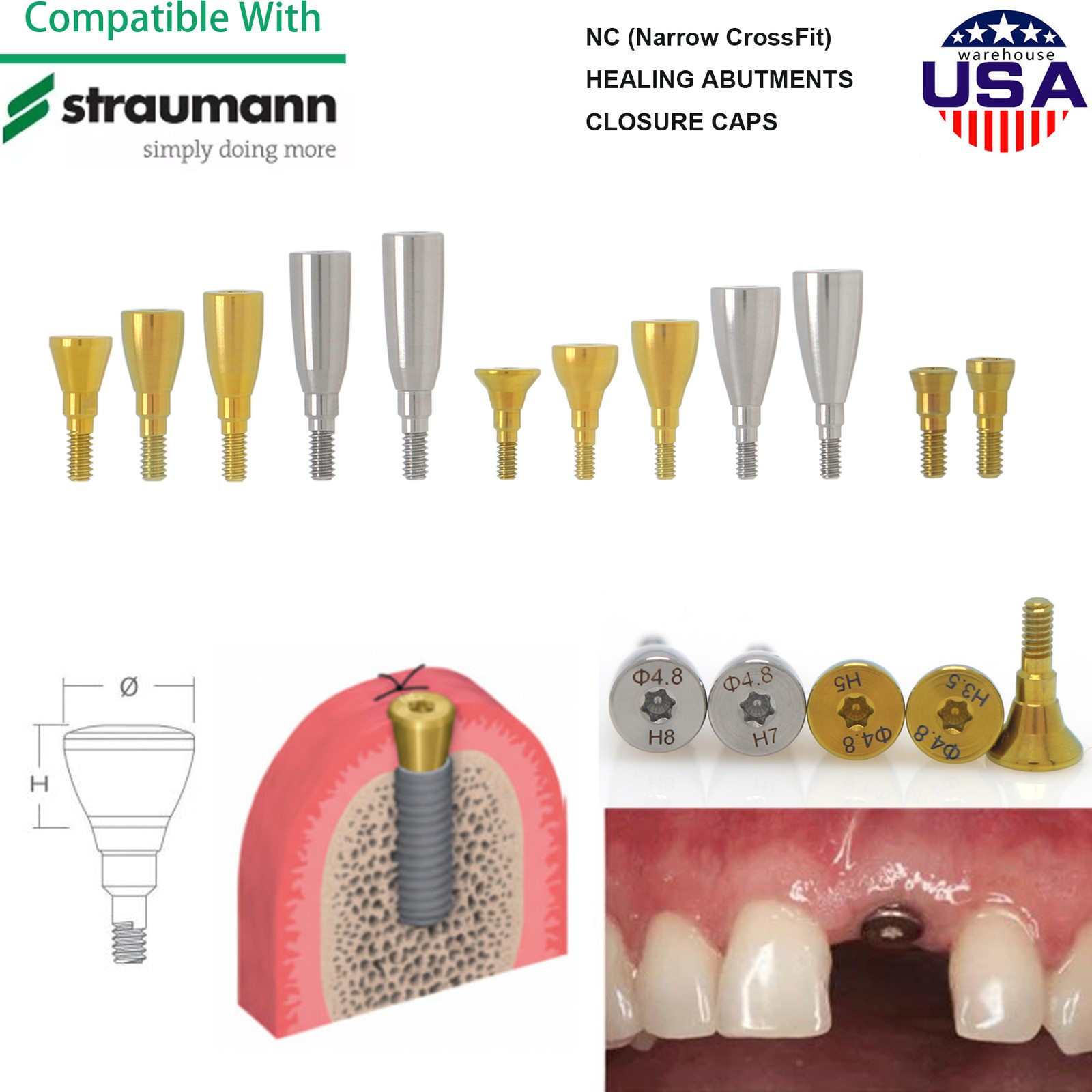 Straumann Implant Healing Abutment Scan Body Lab Analog Impression Coping BL BLT
