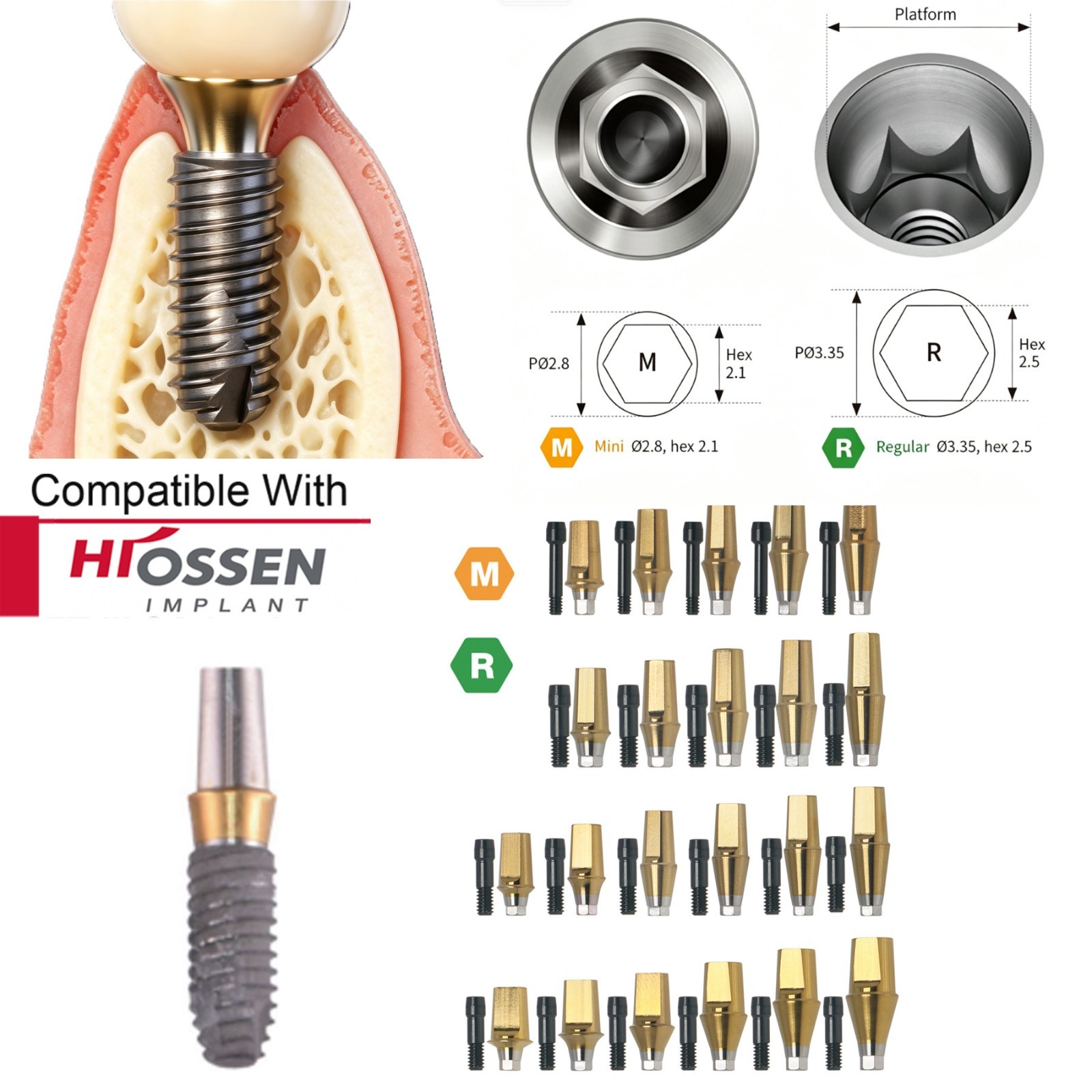 US Dental Prosthetic Abutment Straight & 17° Hex Angled Fit Osstem & Hiossen M/R