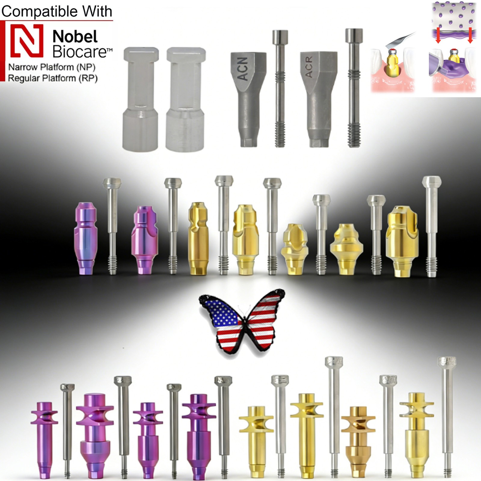 US Implant Nobel Biocare Hex Healing/Impression Coping/ScanBody/Locator Abutment