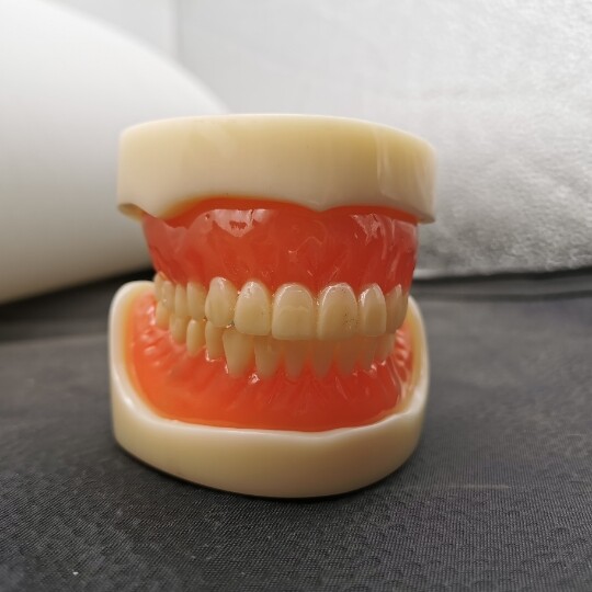Dental 4 Implants Overdenture Typodont Restoration Upper Lower Lower Teeth Model