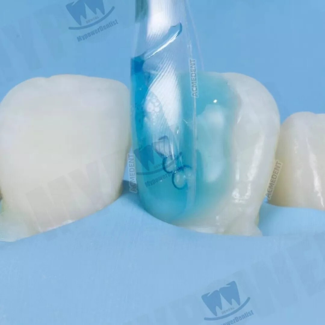 Dental Clear Matrix Diastema Matrices Wedges Similar with BioClear Matrice