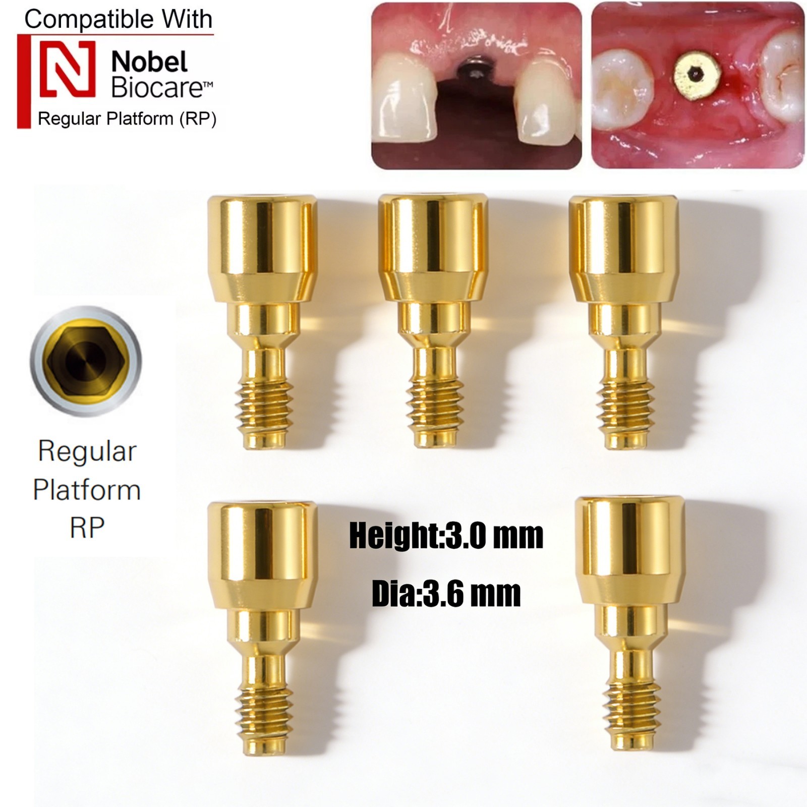 US 5Pc Dental Healing Abutment NP/RP Fit Nobel Biocare Internal Conical Titanium