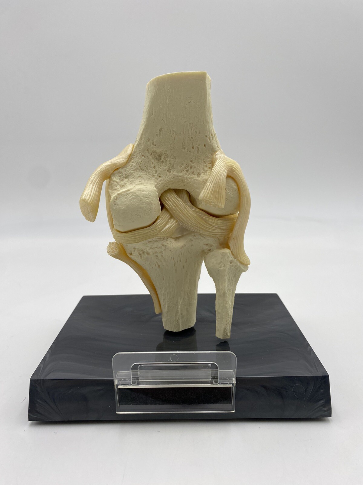 GPI Anatomical – GP1000 – Basic Knee Join Model