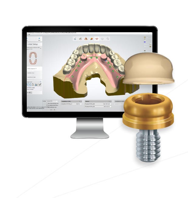 US Implant Nobel Biocare Hex Healing/Impression Coping/ScanBody/Locator Abutment