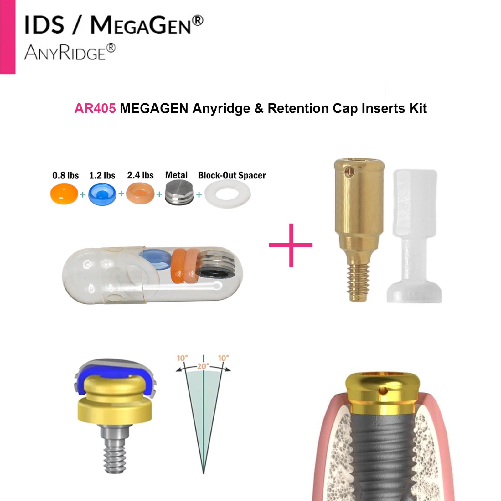 Dental Overdenture Locator Abutment Anchor for MEGAGEN AnyRidge 4.0 Platform Cap