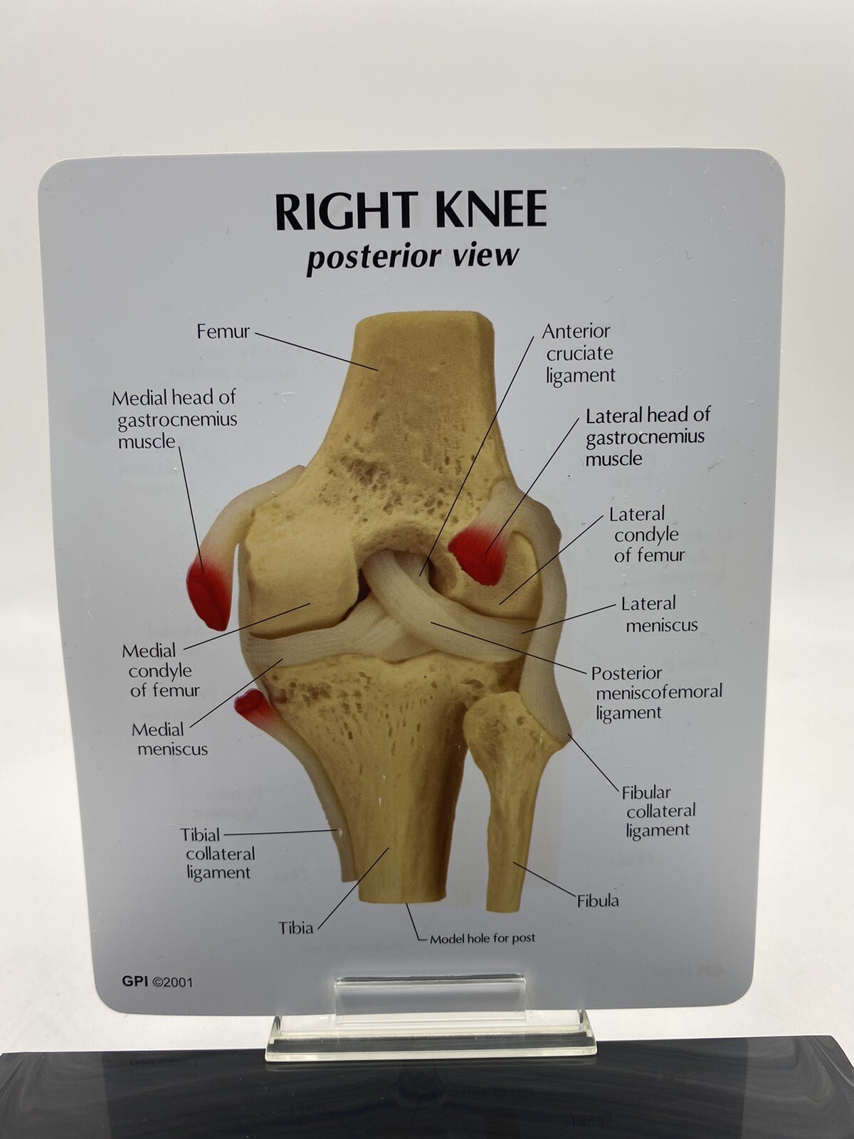 GPI Anatomical – GP1000 – Basic Knee Join Model
