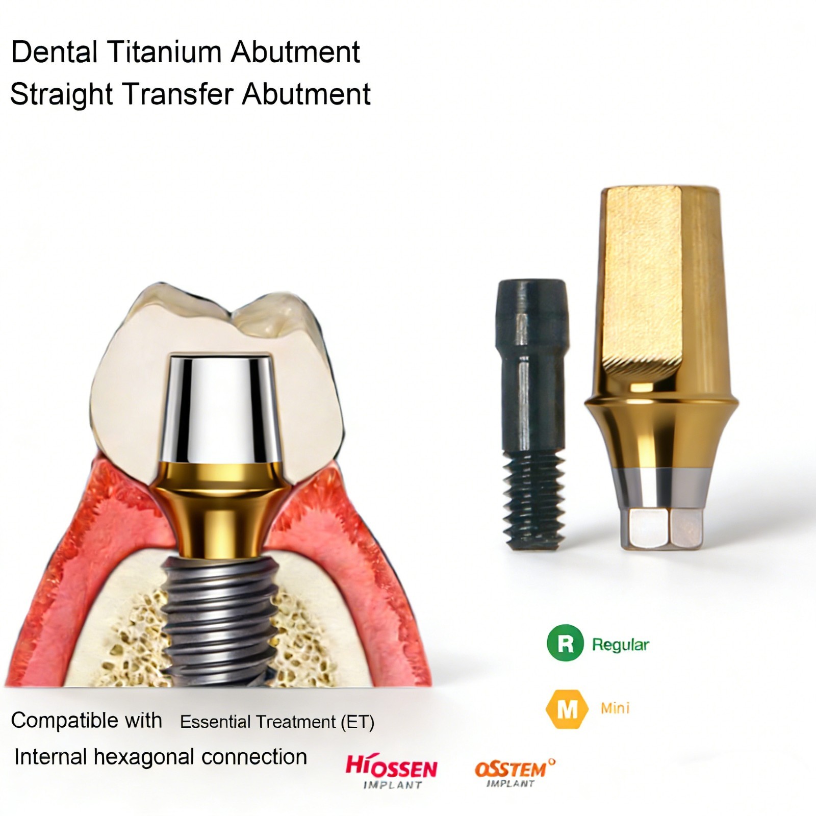 Hiossen Dental Straight Titanium Cemented Abutment Hex Fit Implant Crown Bridge