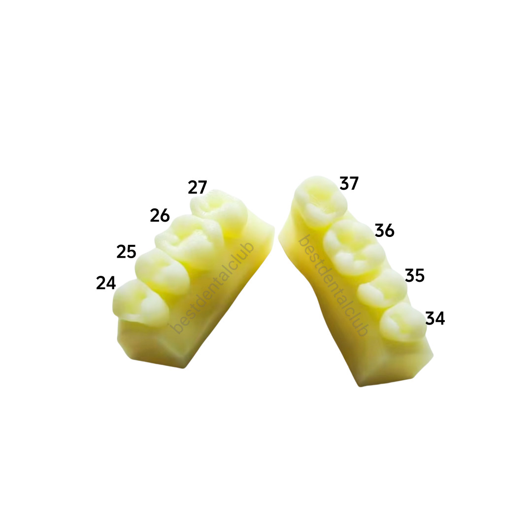 1Set Dental Molar Caries Decay Teeth Model Composite Resin Restore Tooth Simulat