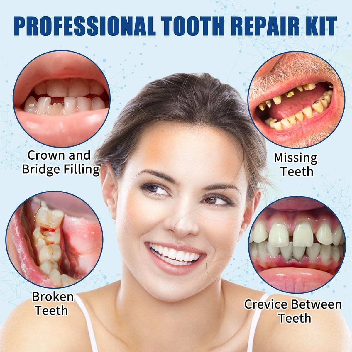Effective Temporary Tooth Repair Kit – Zinc Oxide for Affordable Smiles – 2PCS