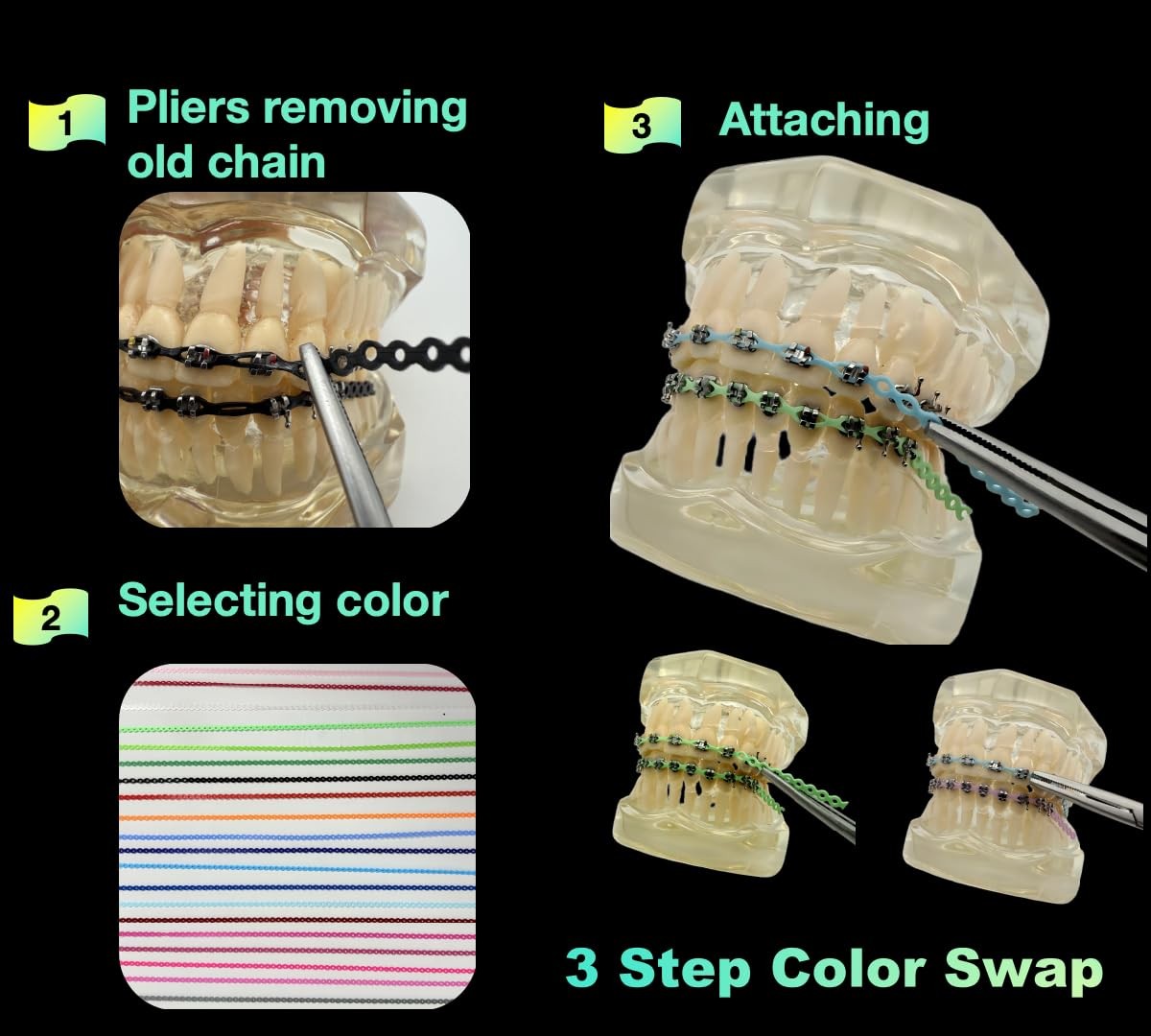 DIY Braces Power Chain Kit – 20Pcs (8.6In/pc) Multi-Color Elastic Multicolor