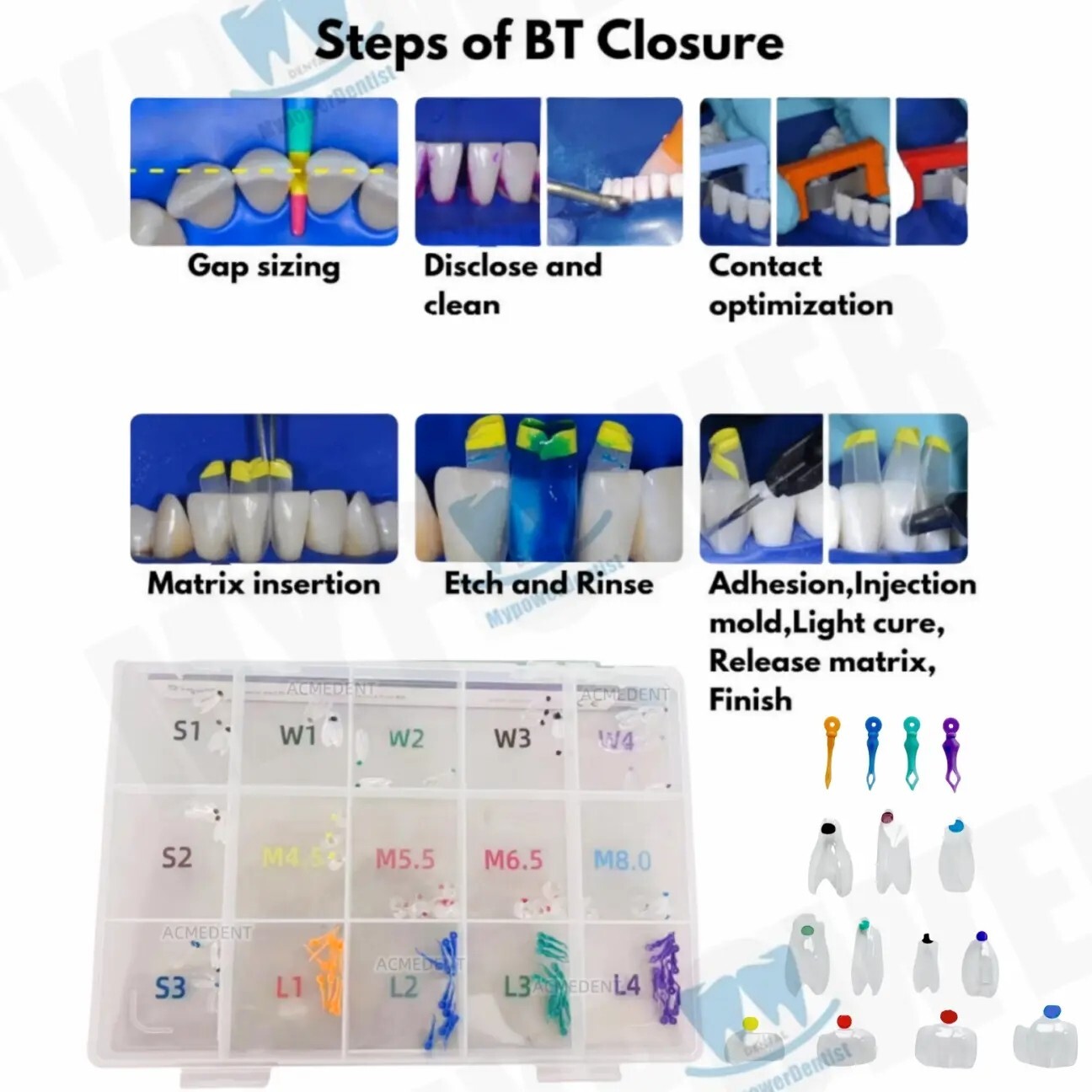 Dental Clear Matrix Diastema Matrices Wedges Similar with BioClear Matrice