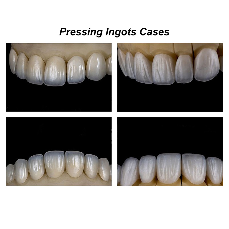 10pcs Dental Disilicate Lithium HTLT Glass Ceramic Block Dentist Veneer Material