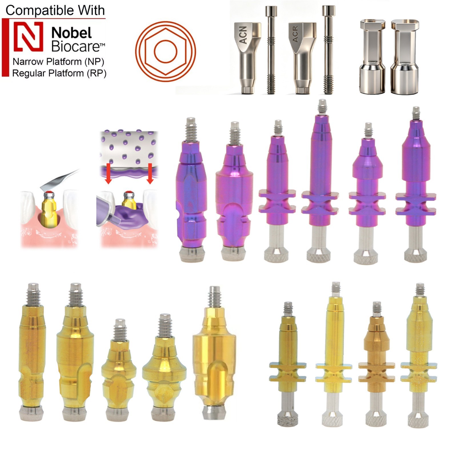 Dentaltech Closed/Open Tray Impression Copings Nobel Biocare Implant Compatible