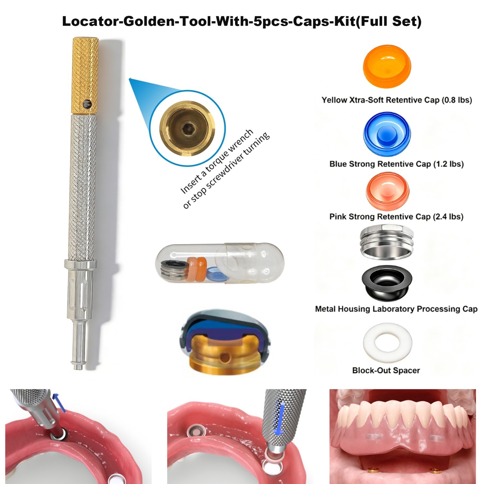 US Universal ZEST Locator PEEK Retention Cap Insertion Lab Core Extraction Tool