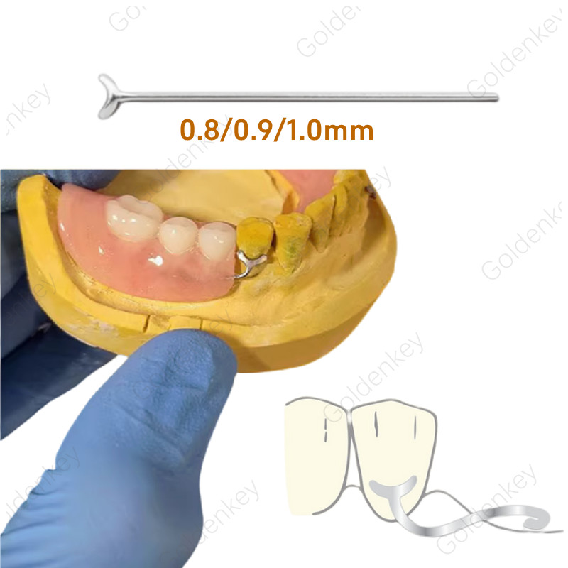 Dental Ball Retainer J Clasp 0.7/0.8/0.9/1.0 Bars Scheu Anchor Position Hold
