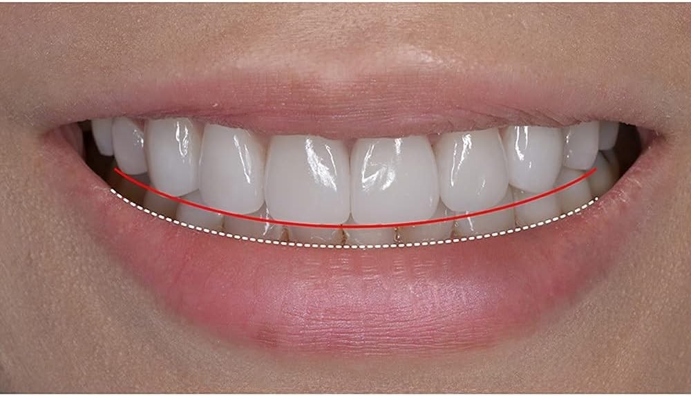 New Silicone Gel Smile Upper and Lower Cosmetic Teeth Tooth Cover Perfect Smile