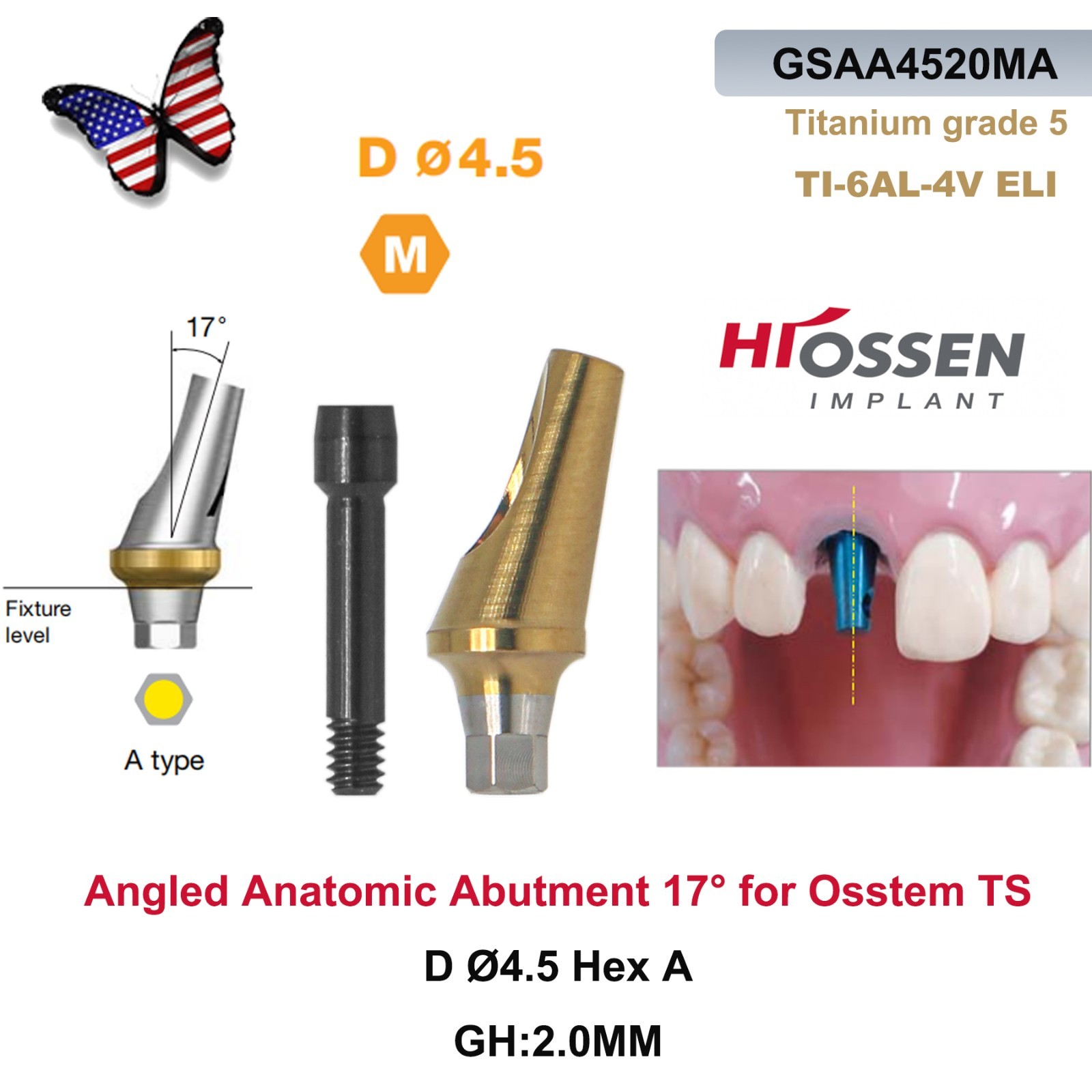 US 17° Angulated Abutment Mini Hex for Osstem TS Mini NP Platform Titanium Screw