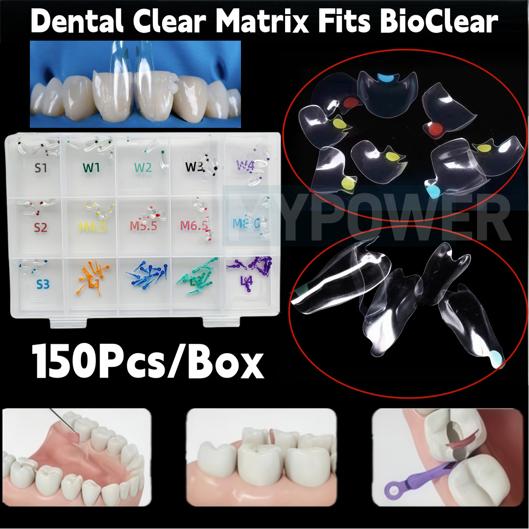 Dental Clear Matrix Diastema Matrices Wedge Similar with BioClear Matrice 150Pcs