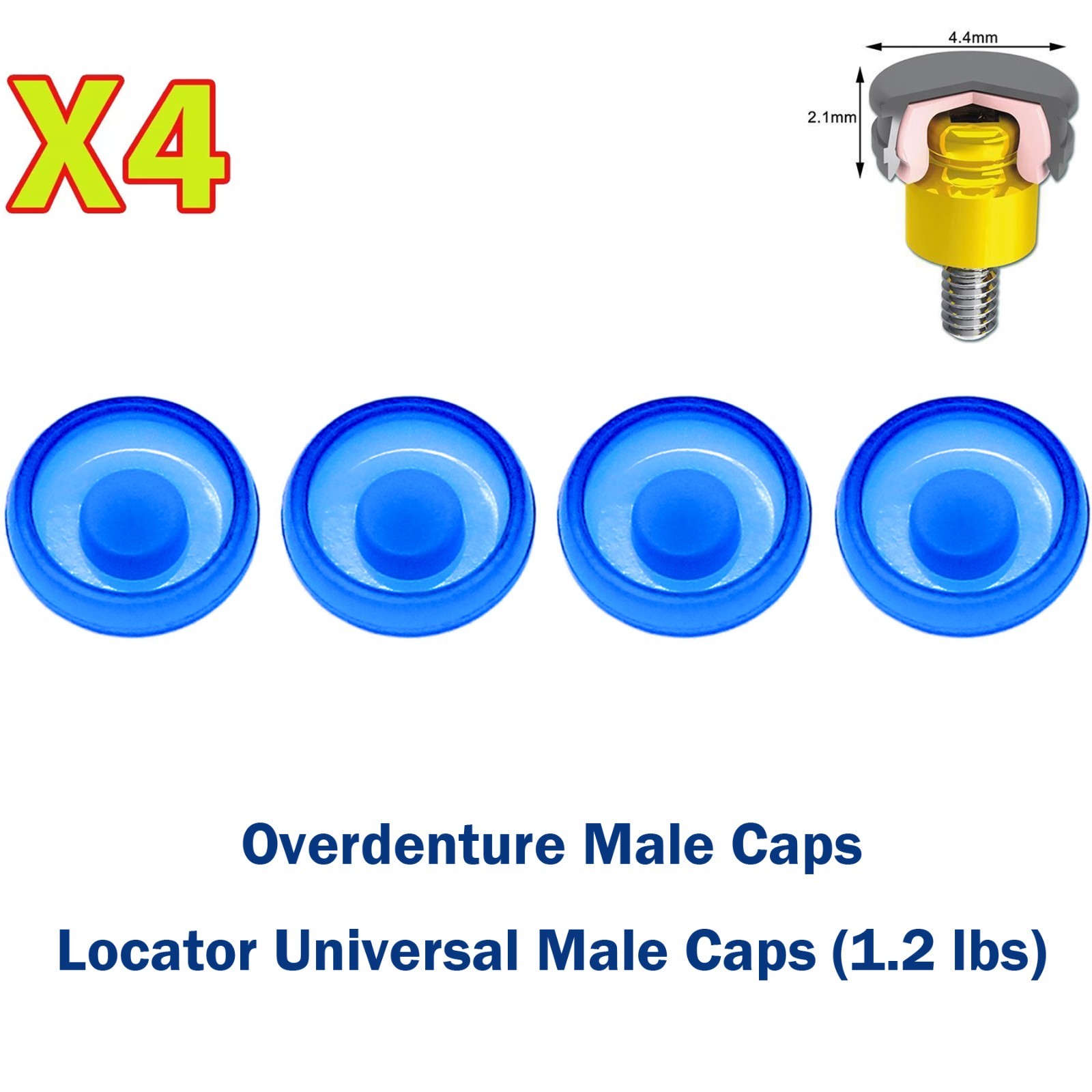 For MegaGen AnyRidge Locator Abutment GH 1-7mm & Overdenture Male Caps Removable