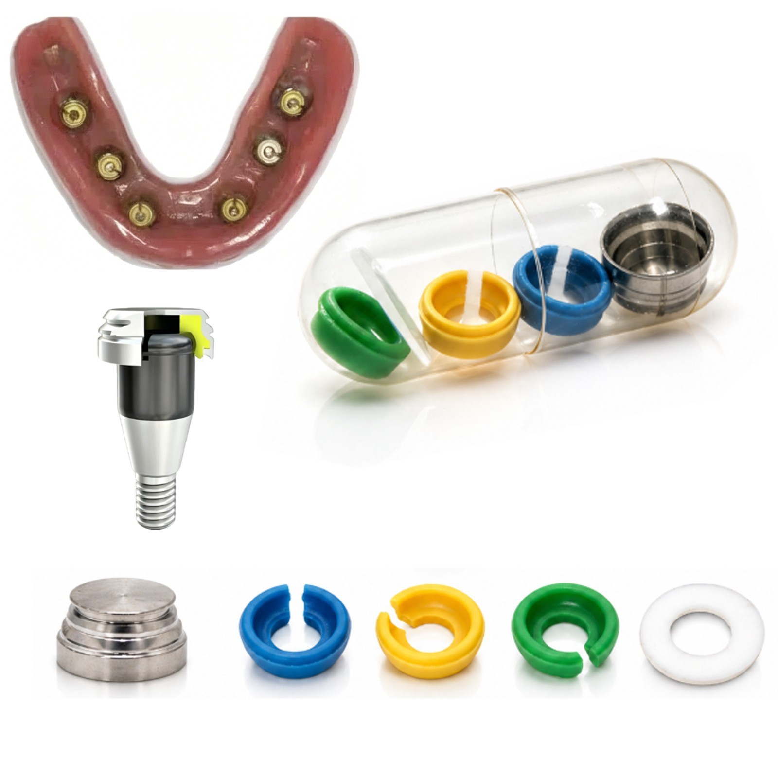 US Dental Novaloc Retention Inserts & Mounting/Demounting Tool Kit Overdenture