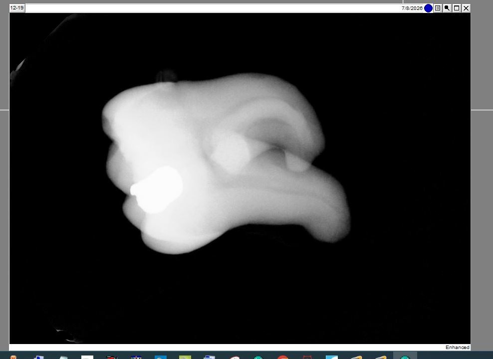 Dexis/Kavo IXS Size 2 Sensor _SEE PICTURES AND IMAGES_