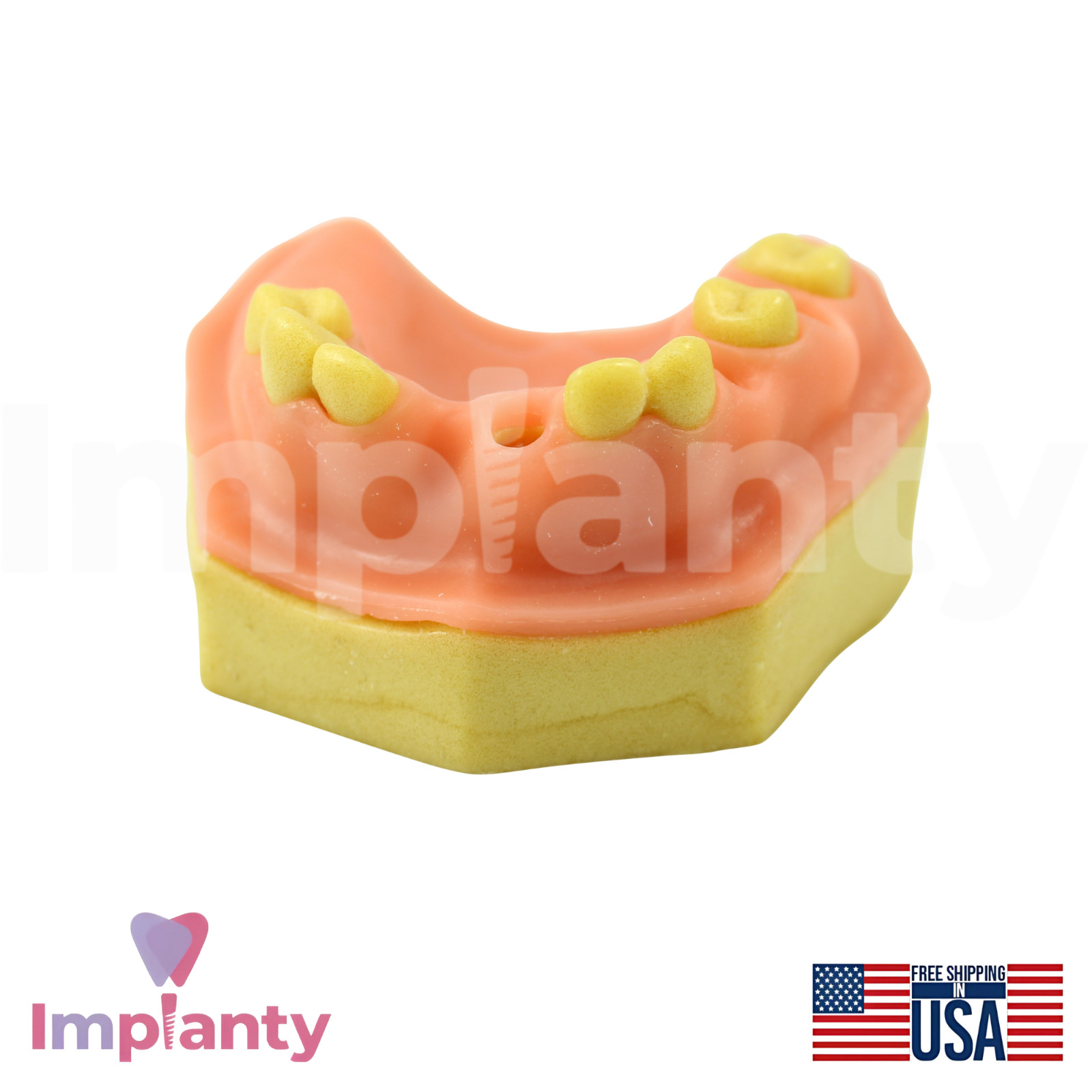 Upper Jaw Model With Missing Teeth Dental Teaching and Dentistry Practice Aid