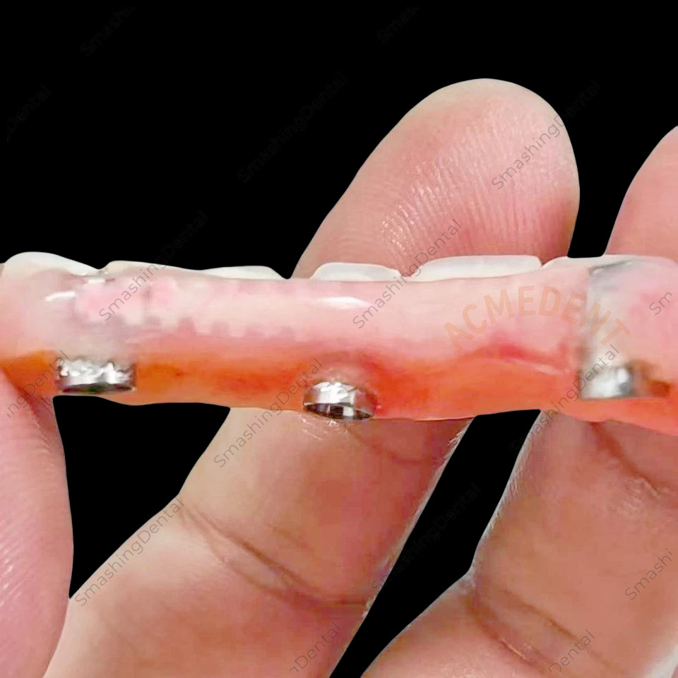 Pink Dental Im plant Connector Wire Overdenture Titanium MU Wires Strengthener