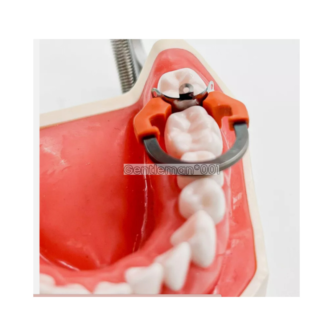 Dental Matrix Band Ring Sectional Matrice Clamp C2 D2/3 Fit Garrison Palodent V3