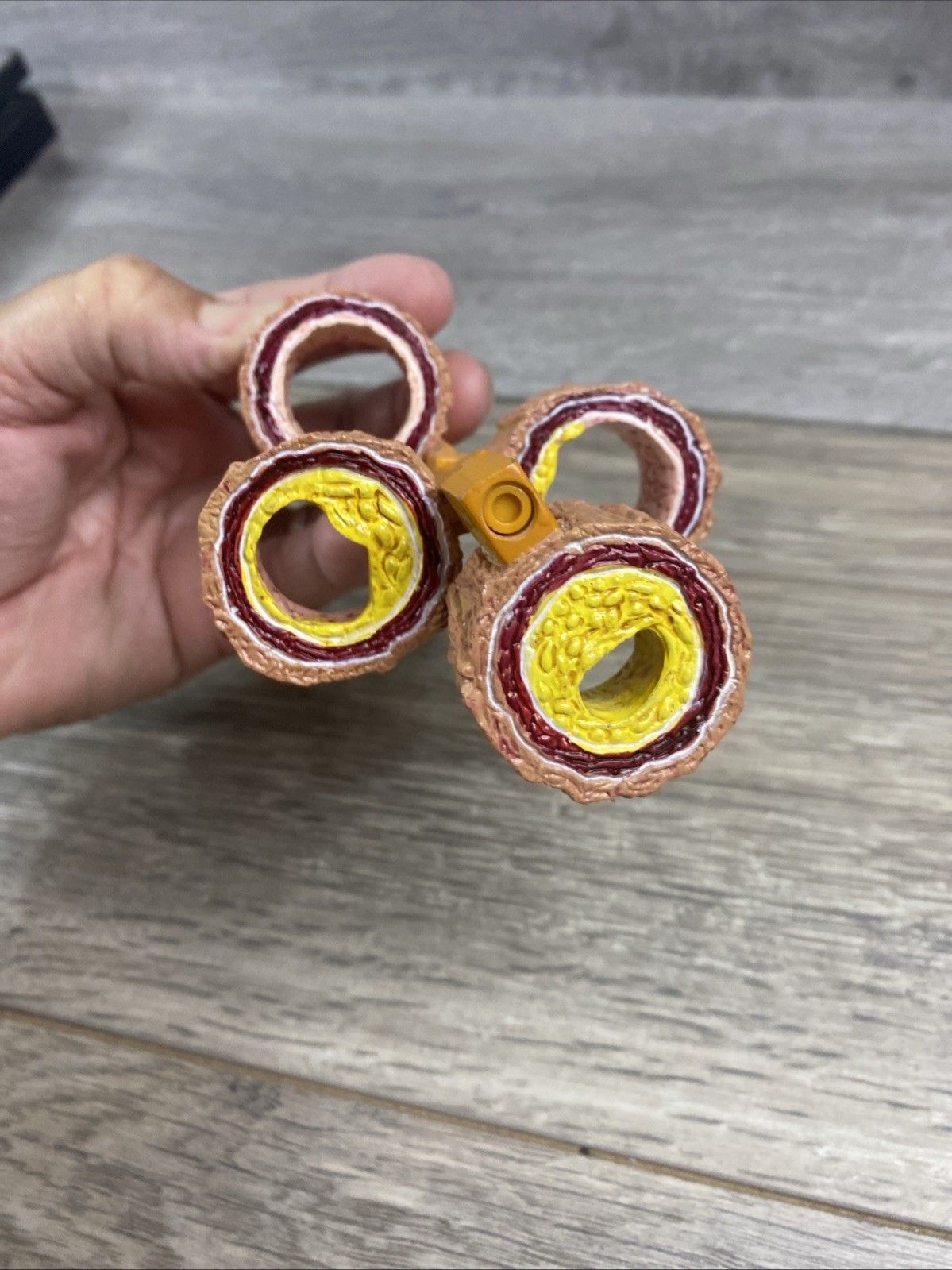 GPI 4-Piece Artery 1 part – Model #2650