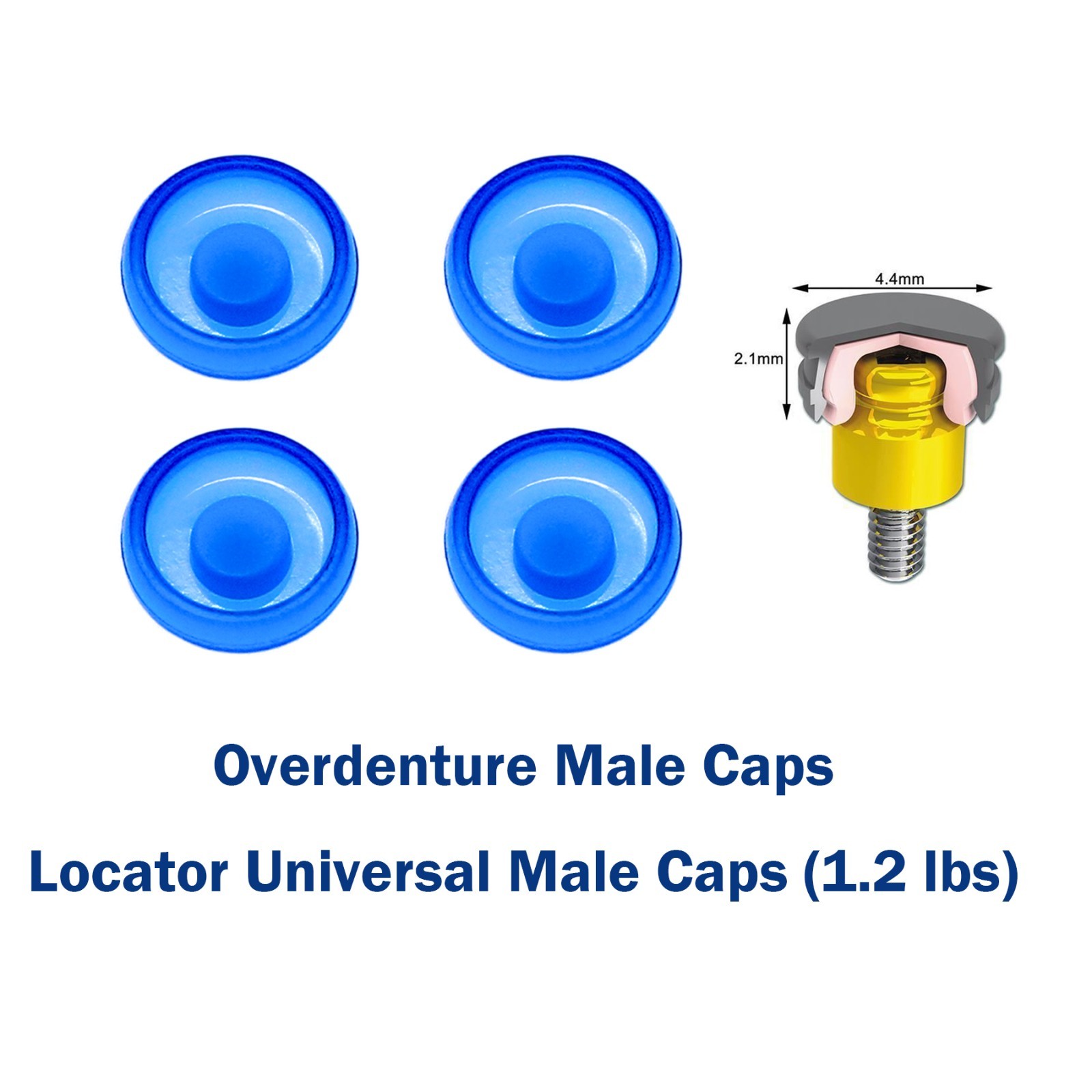 US Dental Overdenture Abutment Removable Male Caps Inserts Standard Blue 1.2 lbs