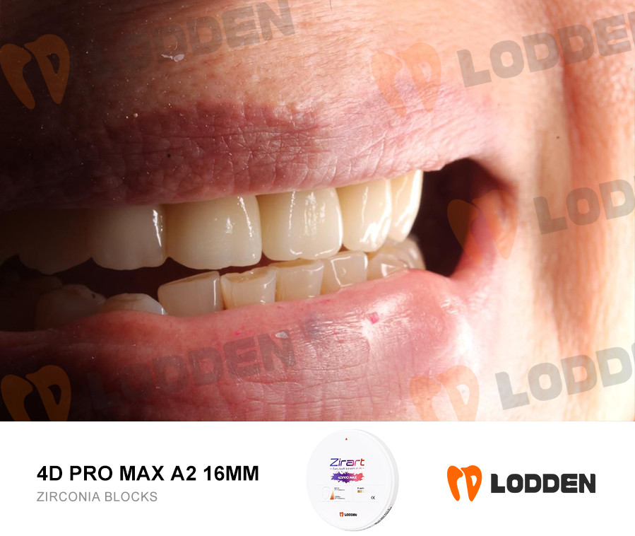 Dental Zirconia Blocks CADCAM System 4D PRO MAX Multilayer Ceramic Disk 8 Layers