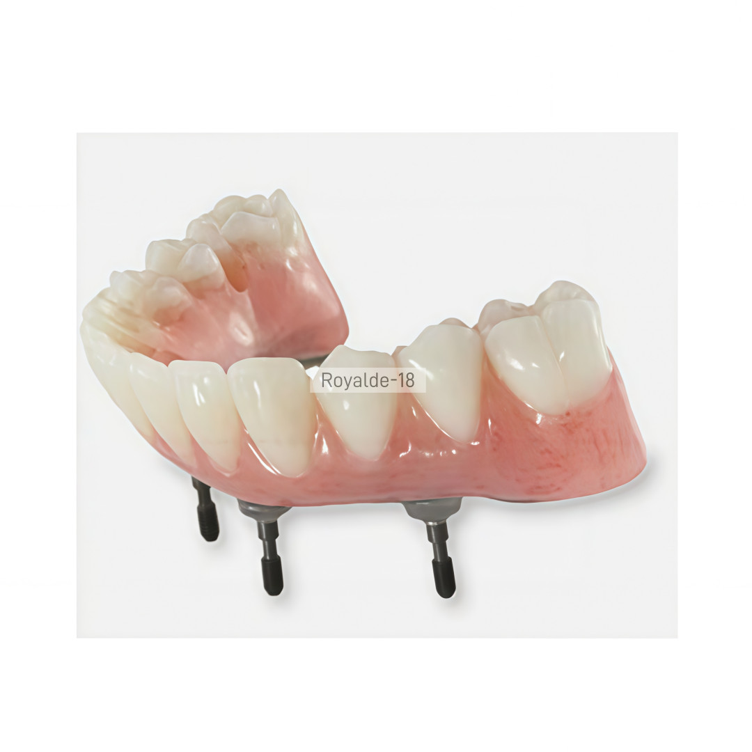 Dental Implan Connector Stainless Tianium Strengthener Wire Overdenture MU Wire