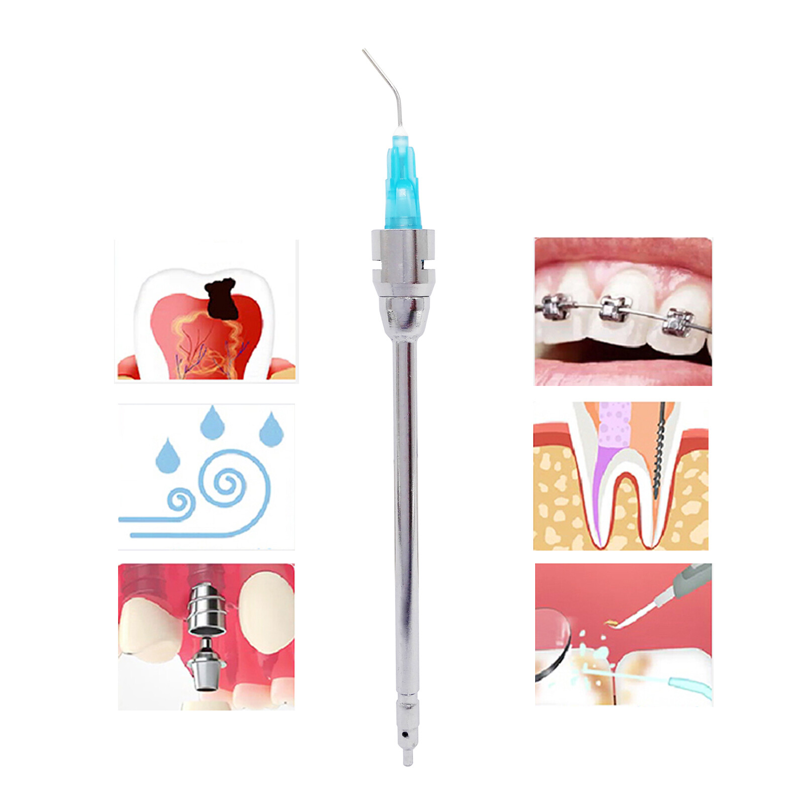 Dental Sybronendo Stropko Kerr Style Air Water Syringe Irrigation Tips 3Way