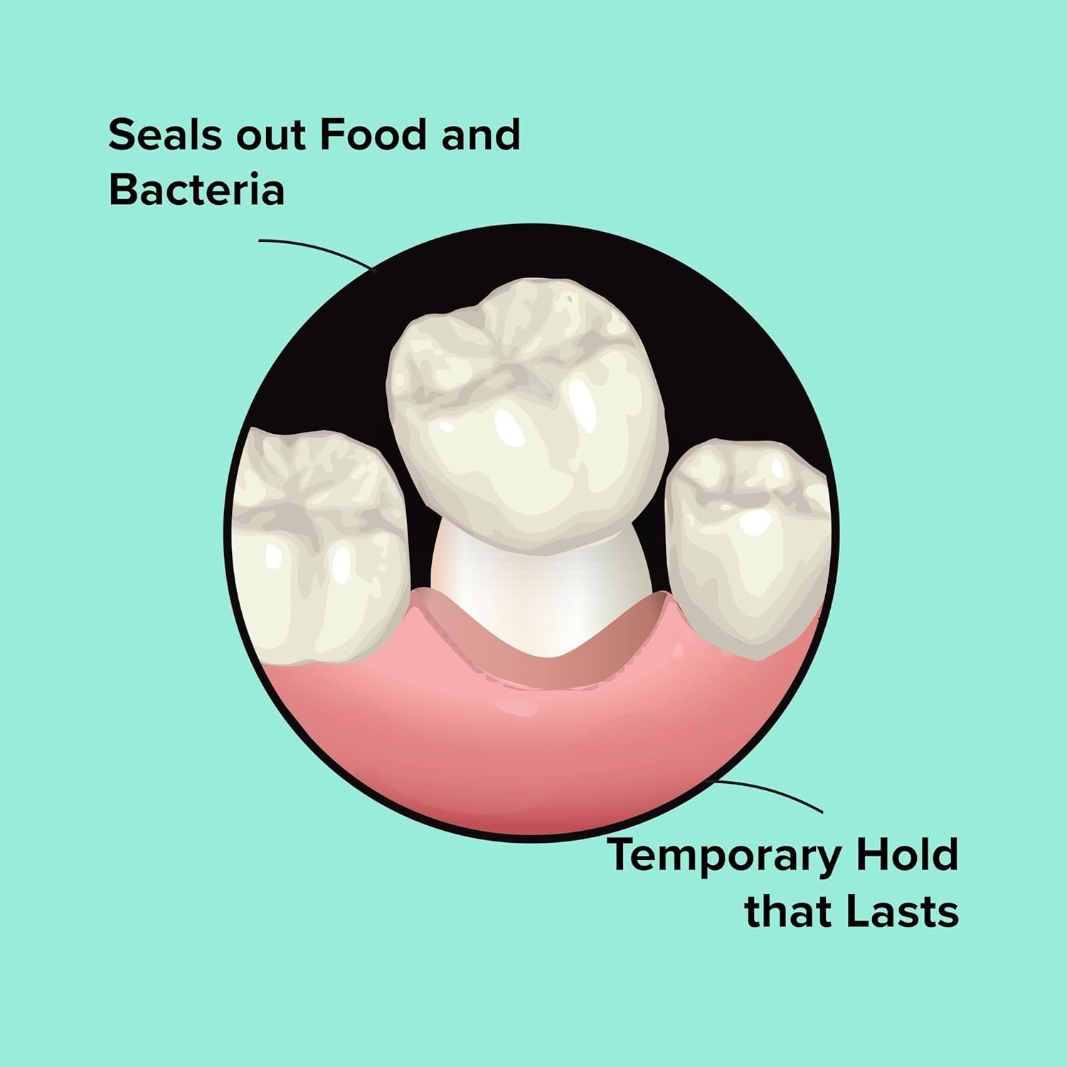 Clear Dental Cement for Crowns – Portable Dental Repair Kit with Applicator