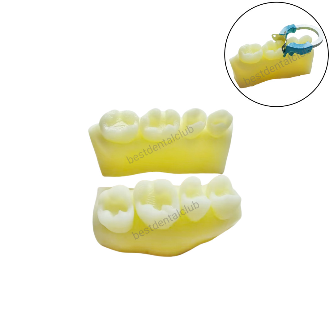 1Set Dental Molar Caries Decay Teeth Model Composite Resin Restore Tooth Simulat
