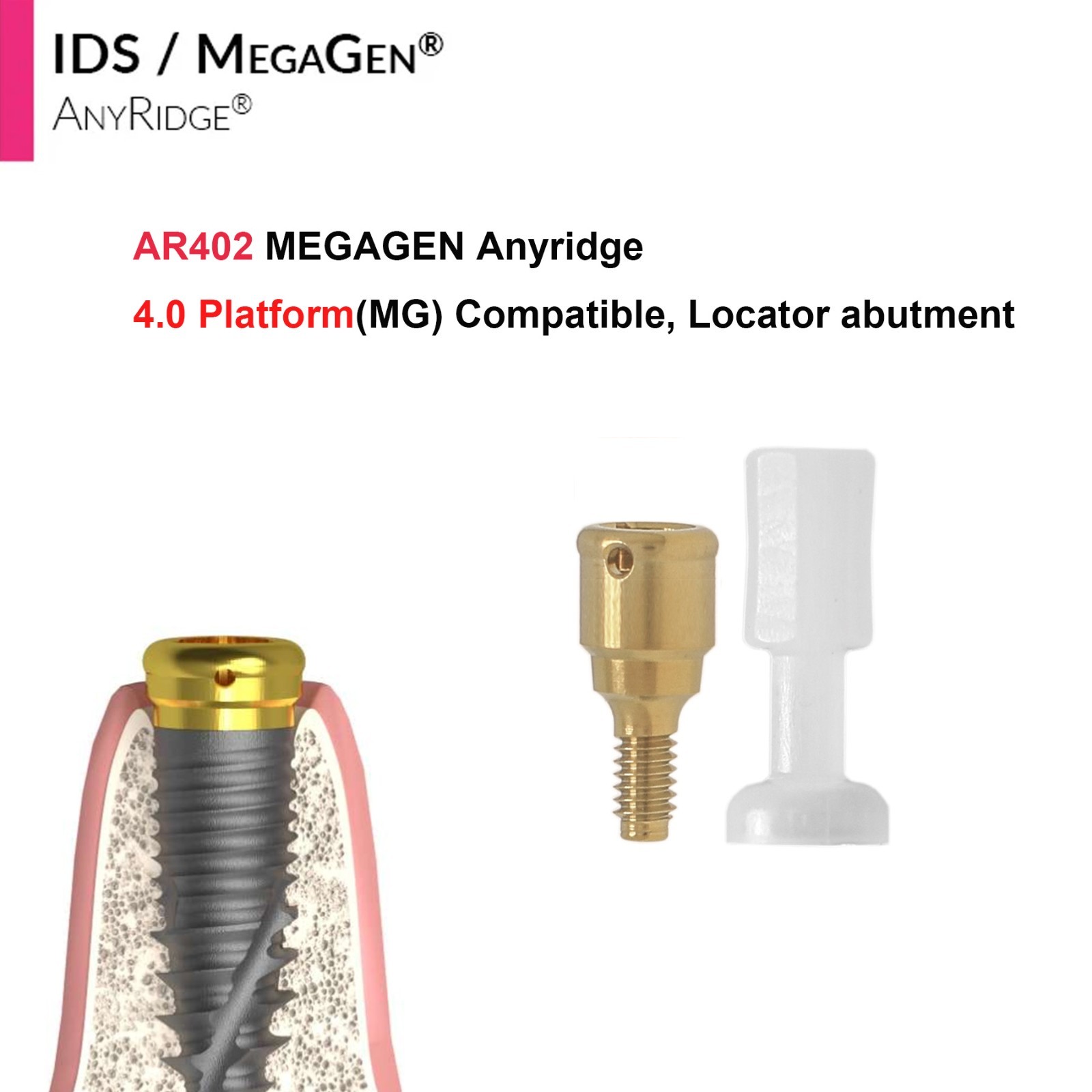 Dental Overdenture Locator Abutment Anchor for MEGAGEN AnyRidge 4.0 Platform Cap