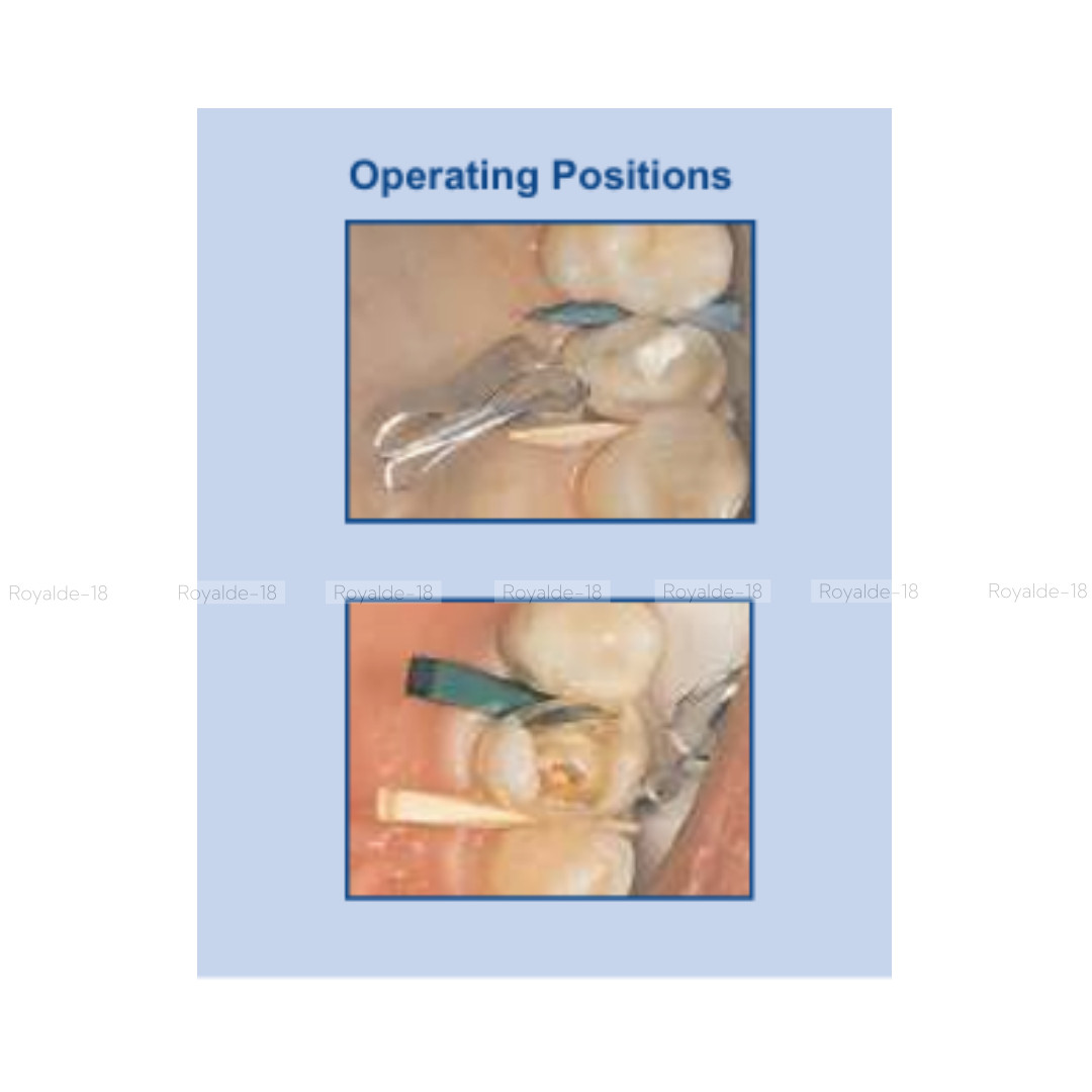 1.096 Dental Transparent Contoured Matrices with Clamp for Premolar & Molar