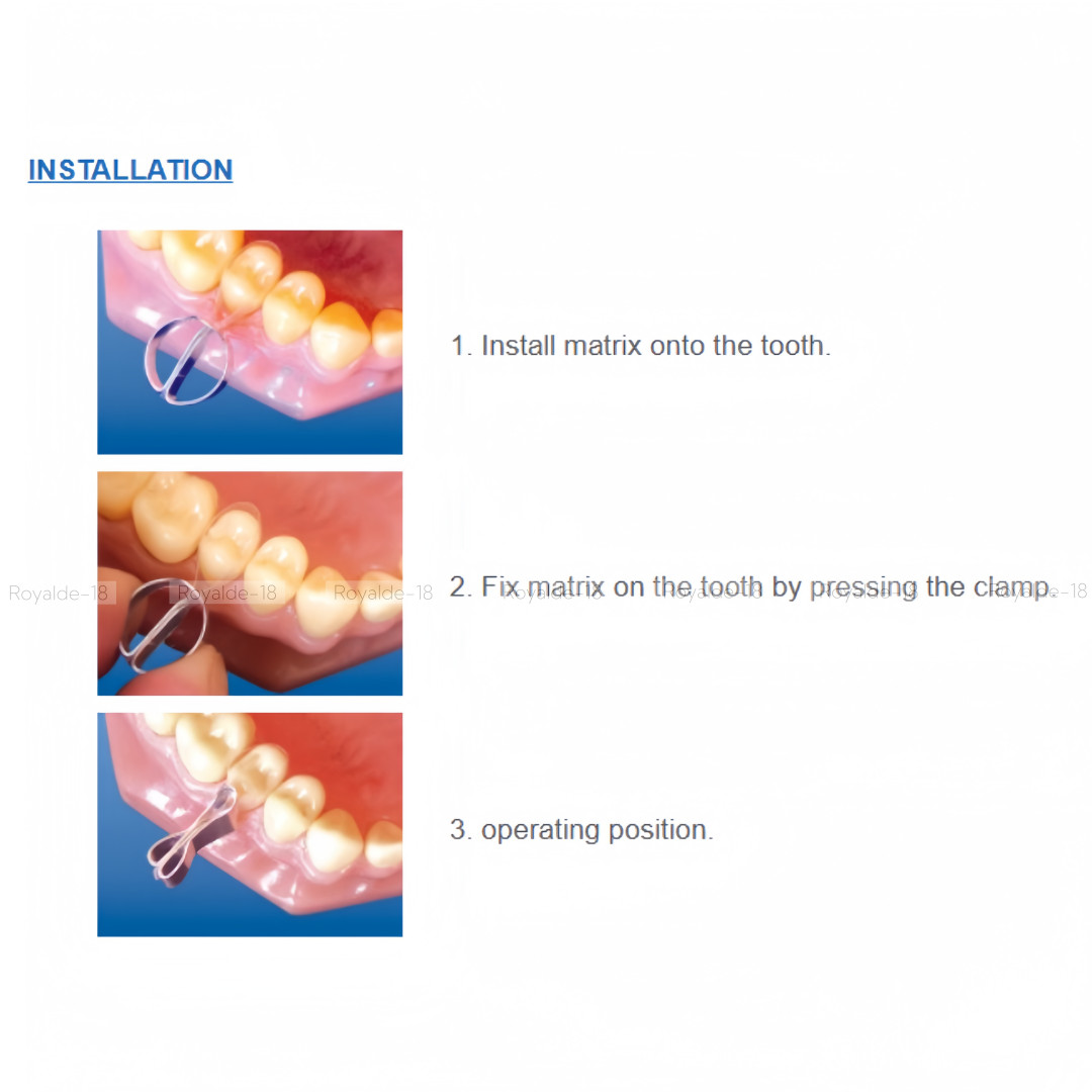 1.096 Dental Transparent Contoured Matrices with Clamp for Premolar & Molar