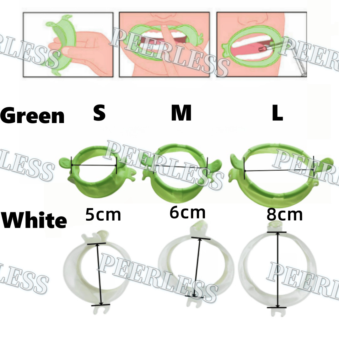 Smile Face Mouth Opener Orthodontic Buccal Mouth Reaming Internal Support S/M/L