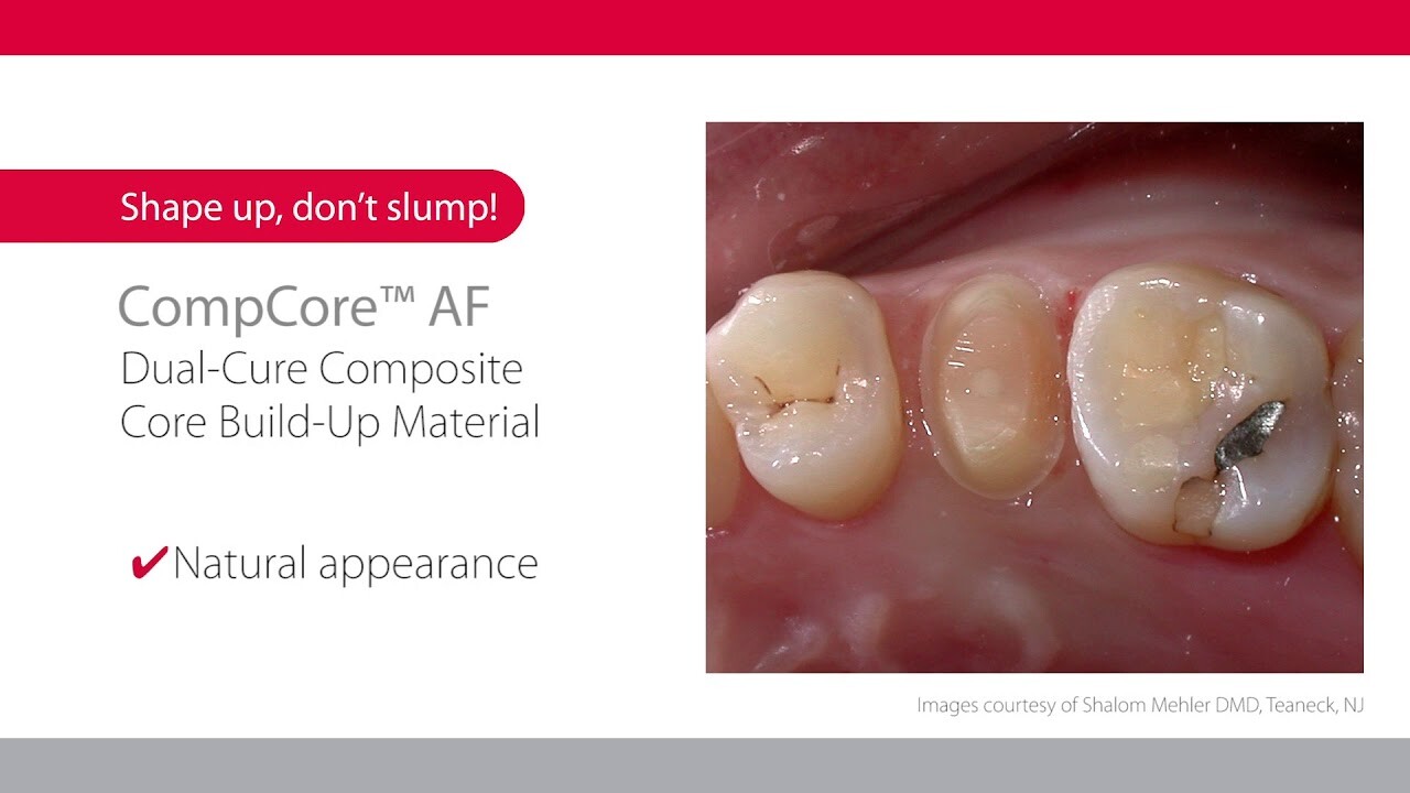 Premier CompCore AF Dual-Cure Core Build-up Material 50gm Refill White + Mix.Tip