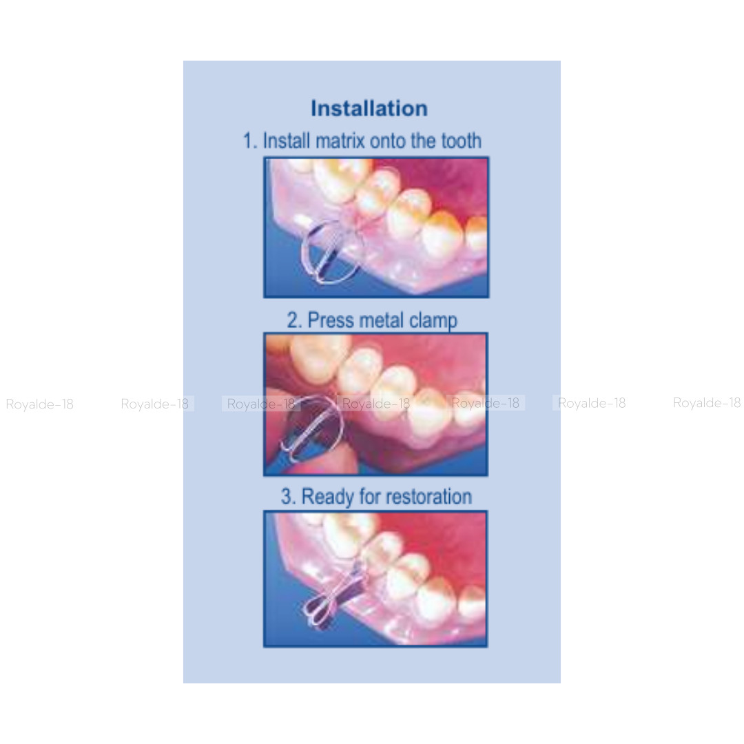 1.096 Dental Transparent Contoured Matrices with Clamp for Premolar & Molar