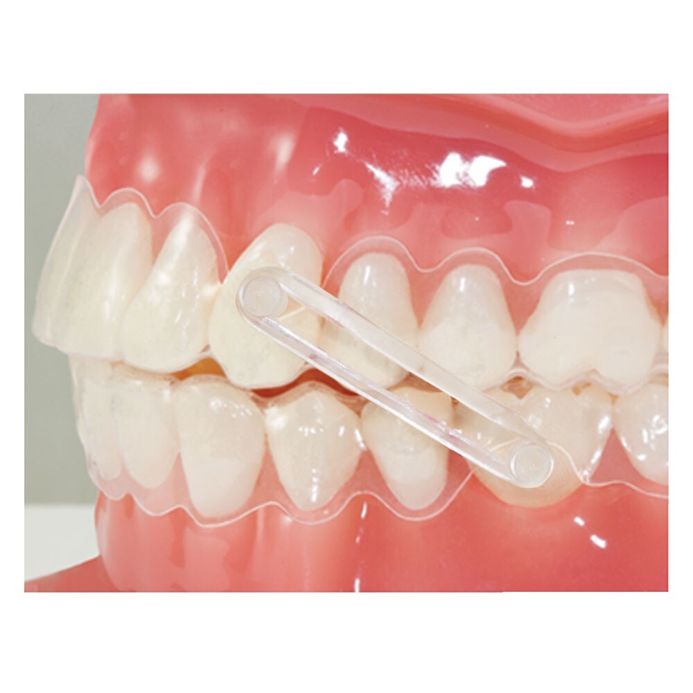 J&J Ortho™ Orthodontic White Ceramic Bondable Button (10/pk)