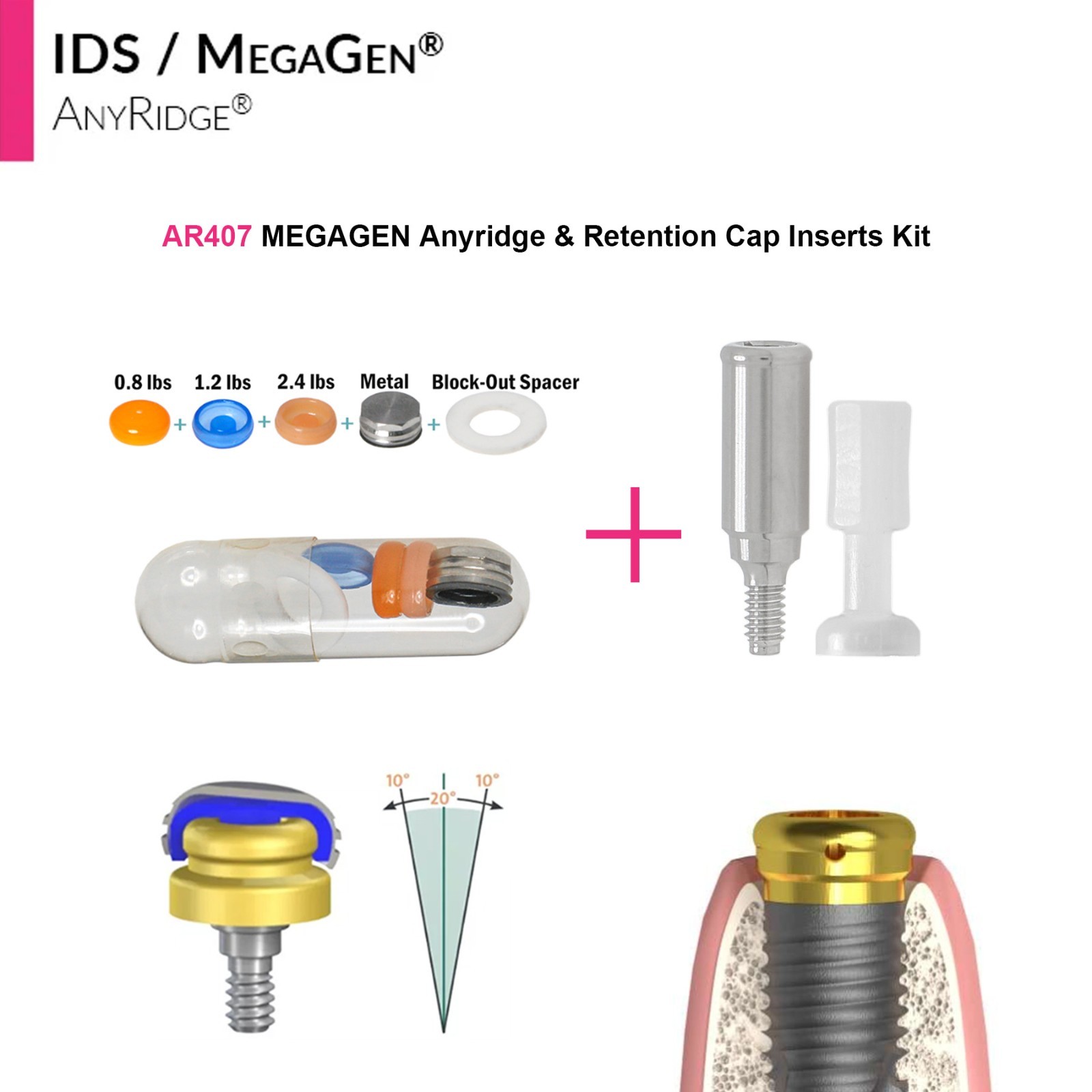Dental Overdenture Locator Abutment Anchor for MEGAGEN AnyRidge 4.0 Platform Cap