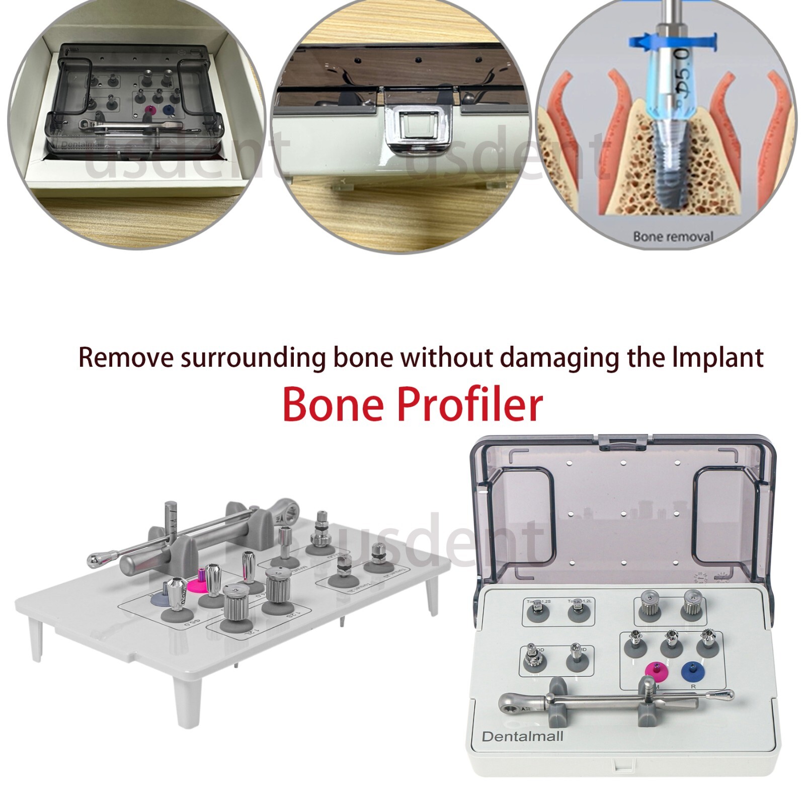 HIOSSEN OSSTEM PROSTHETIC KIT Implant Bone Profilers Torque Wrench Screwdrivers