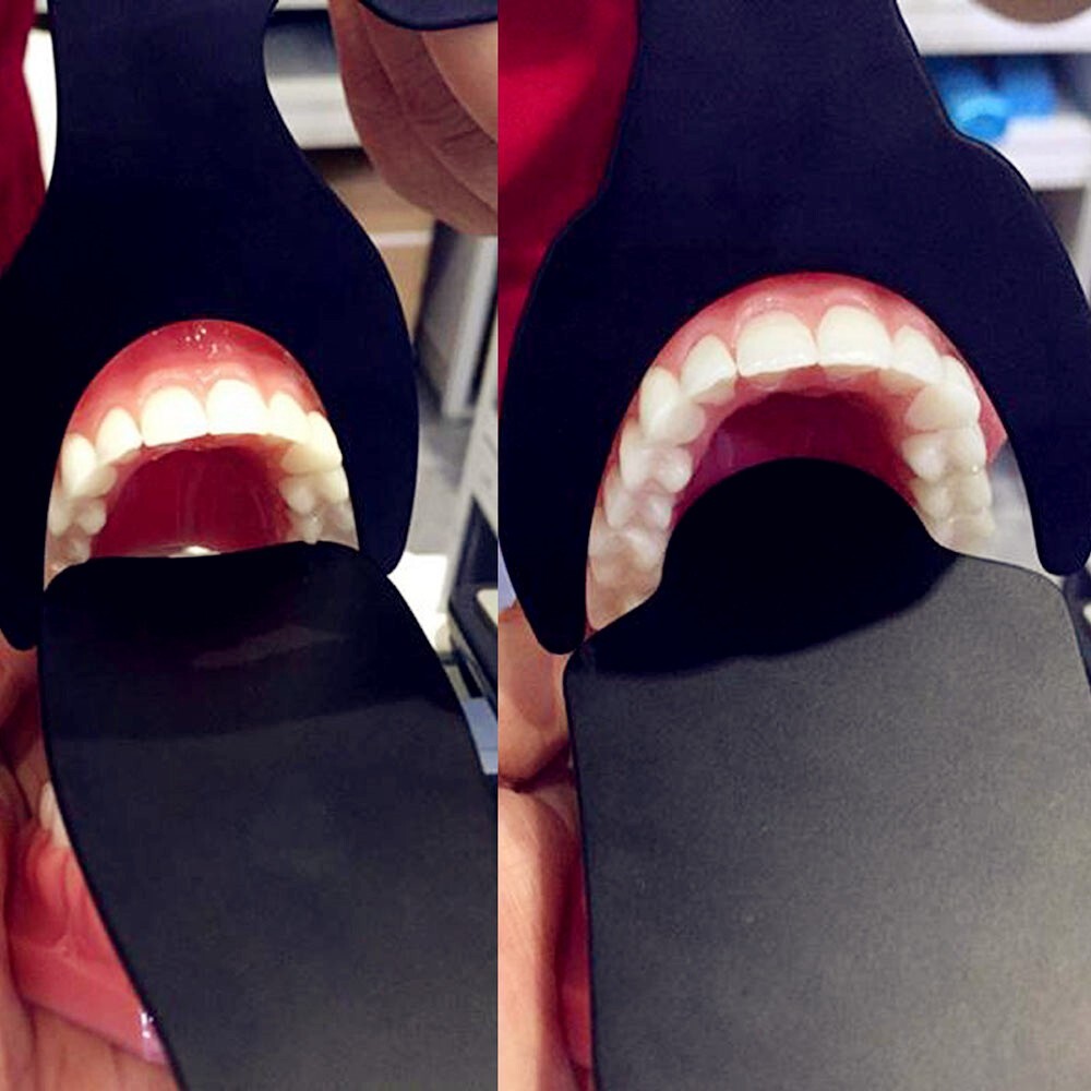 6pcs Dental Photo Contrast Black Background Board Palatal Photography Contraster