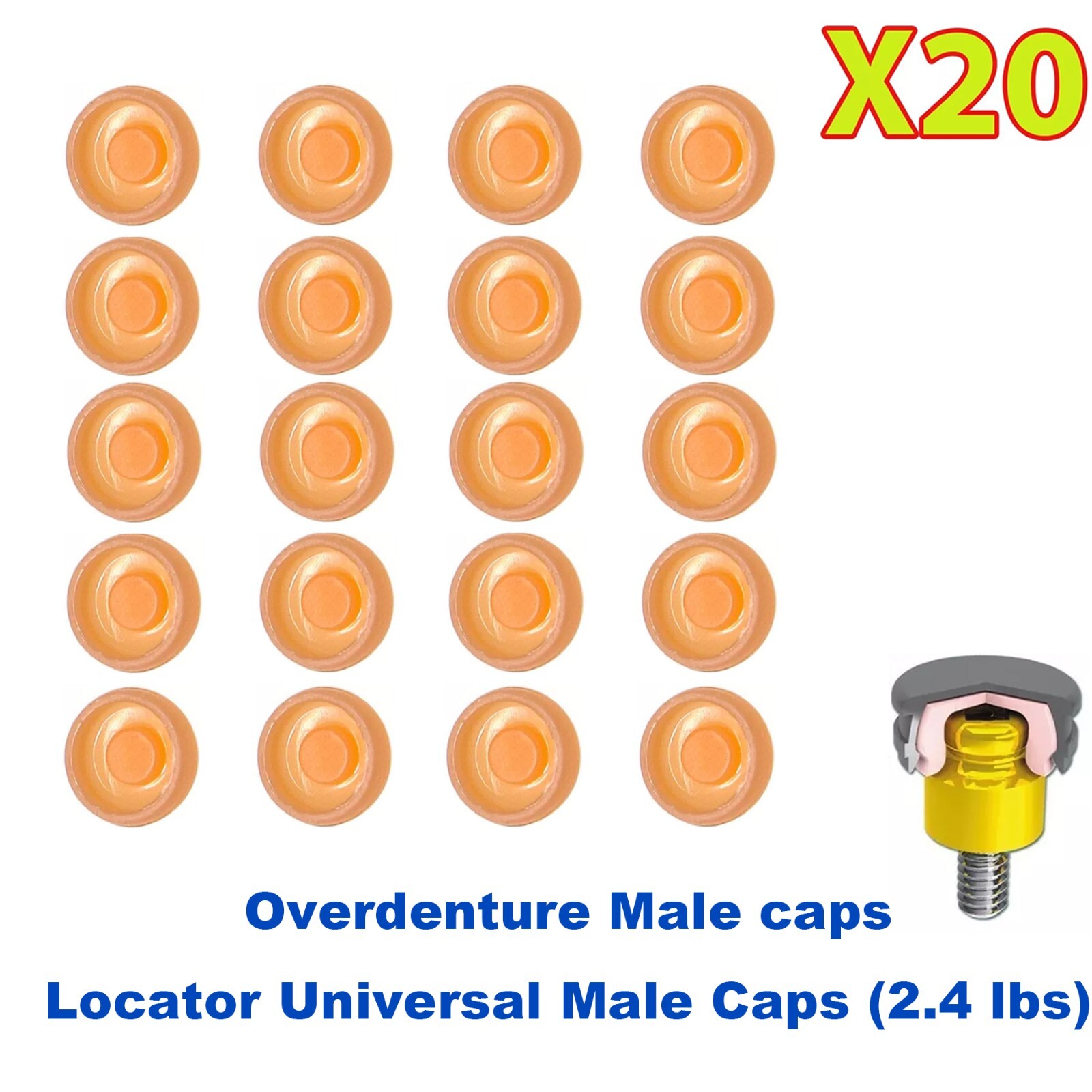 US 20Pcs Dental Overdenture Mini Implants Locator Retentive Caps 1.2/2.4lbs