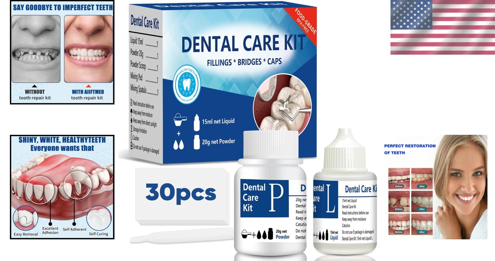 Effective Temporary Tooth Repair Kit – Zinc Oxide for Affordable Smiles – 2PCS