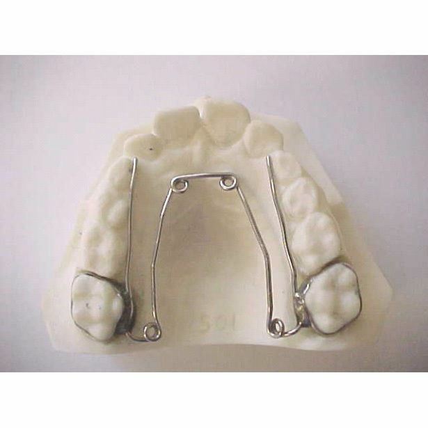 Dental Orthodontic Quad Helix Jaw Expander Cross Bite Treatment 1pcs