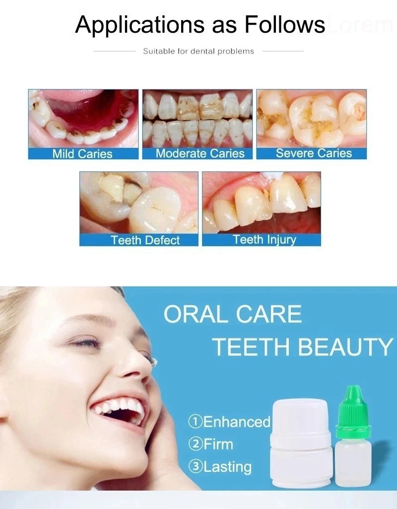 Dental Cement Tooth Repair Cavity Teeth Glue Filling Fixation Powder Liquid Set